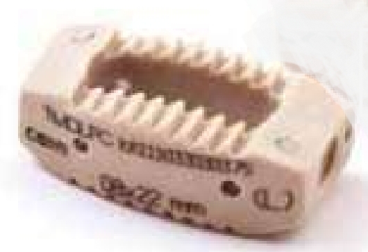 Поперековий PEEK кейдж Tria 11х22х10 мм